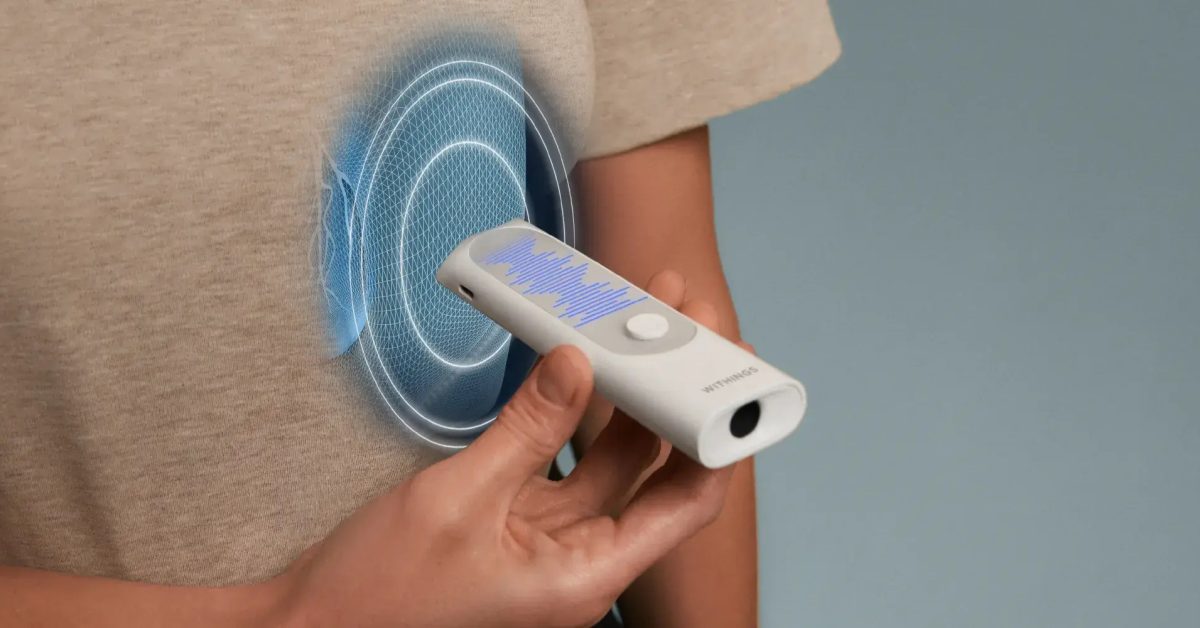 Withings представляет «революционный» мультископ BeamO 4-в-1 с поддержкой Apple Health