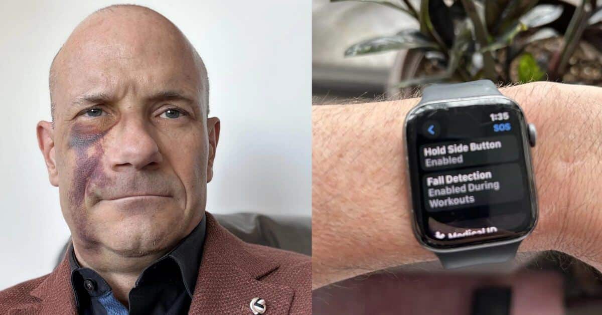 Обнаружение падения Apple Watch помогло спасти велосипедиста после аварии во время ливня