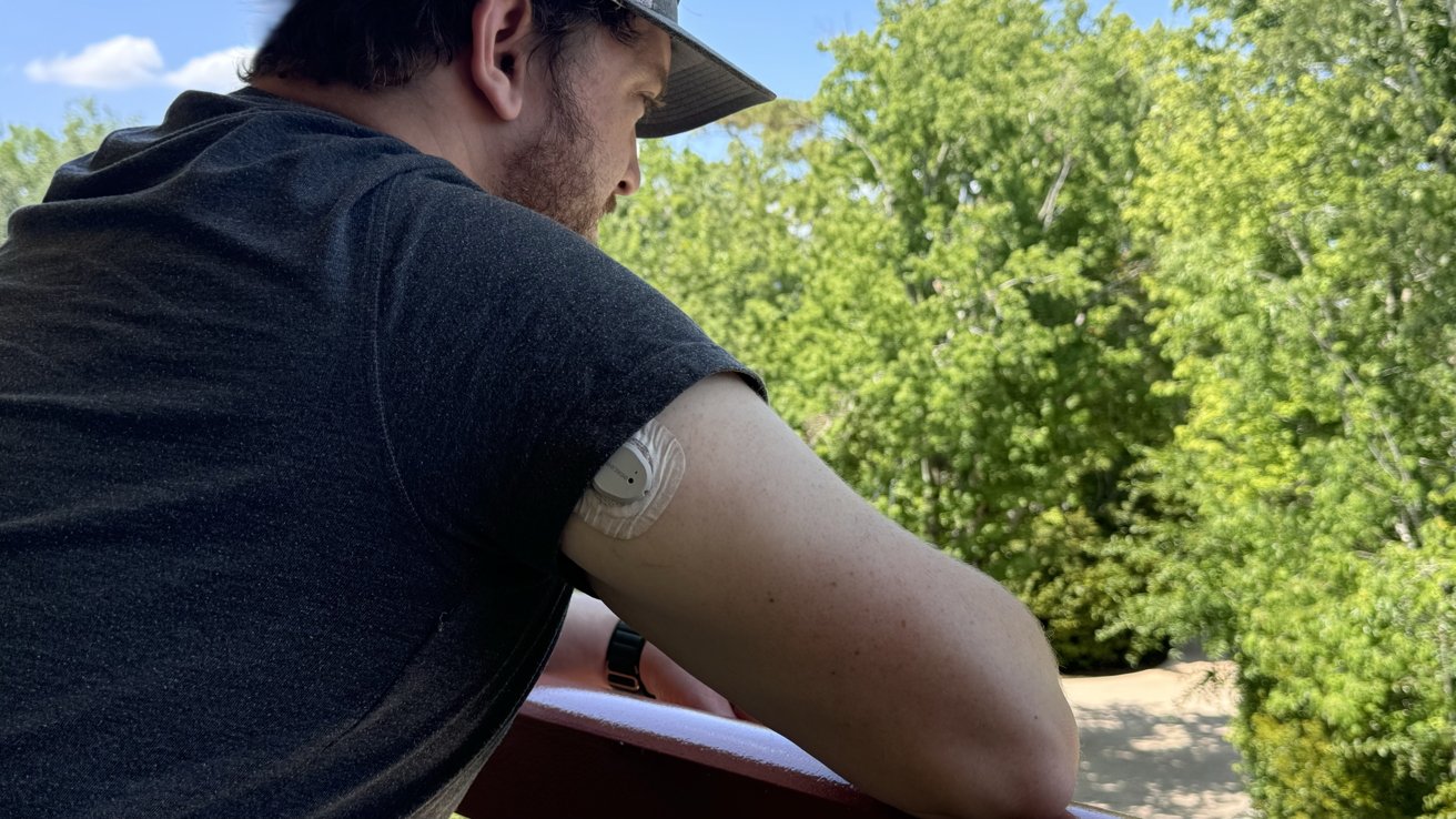 Dexcom G7 на тыльной стороне руки